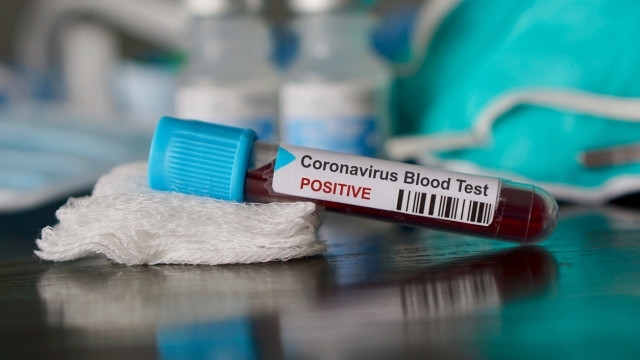 109 са новодиагностицираните с коронавирусна инфекция лица през изминалите 24