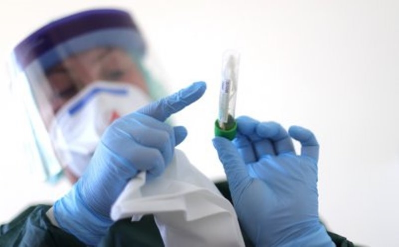 Четири са новите случаи на коронавирус в област Видин през