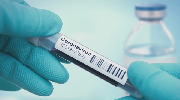 Малко под 400 нови случая на коронавирус са били регистрирани
