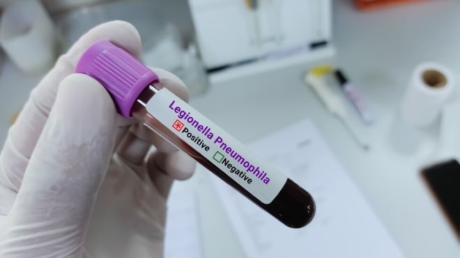 Ето какво е легионерската болест и кои са застрашени от нея