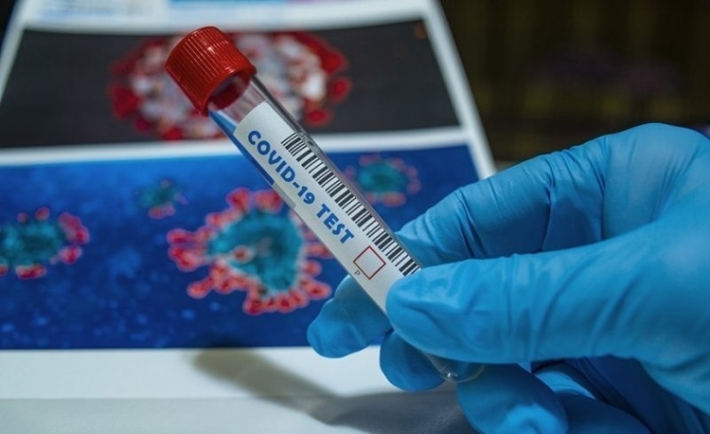 Новите потвърдени случаи на COVID 19 у нас за последното денонощие са 50