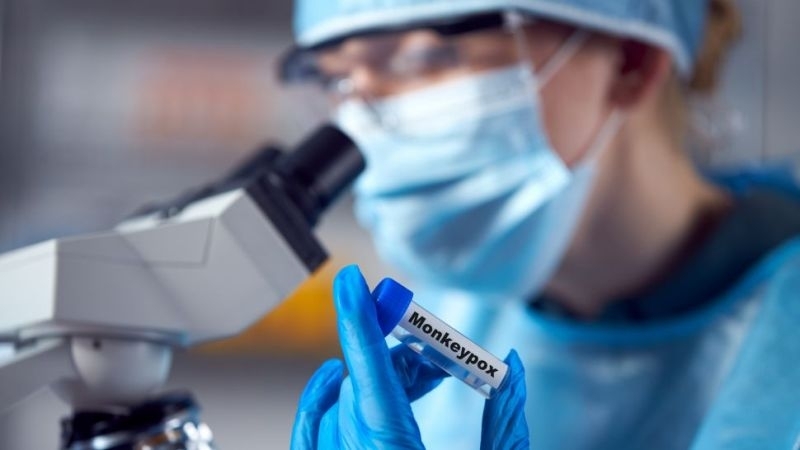 Властите на Ню Йорк обявиха извънредна епидемиологична ситуация заради разпространението на маймунската шарка