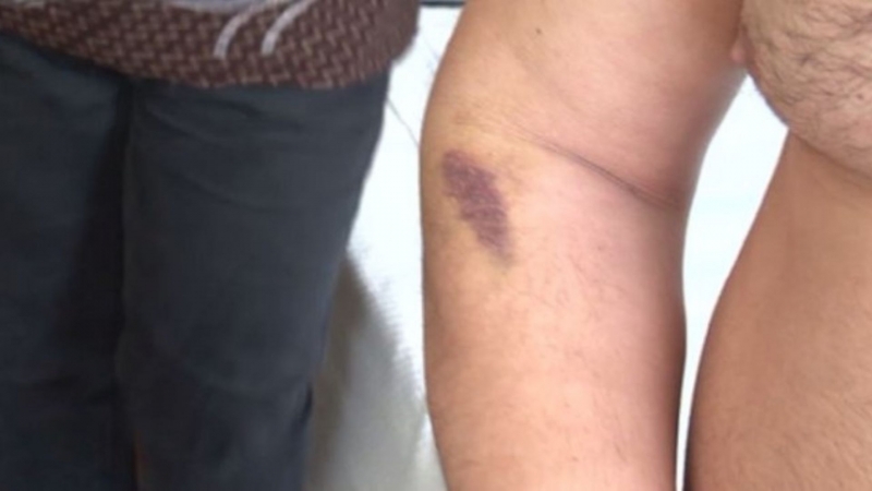 МВР проверява сигнал на майка и син за превишаване на