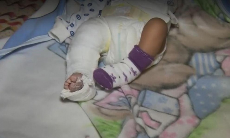 Родители на новородено твърдят че детето им е пострадало по