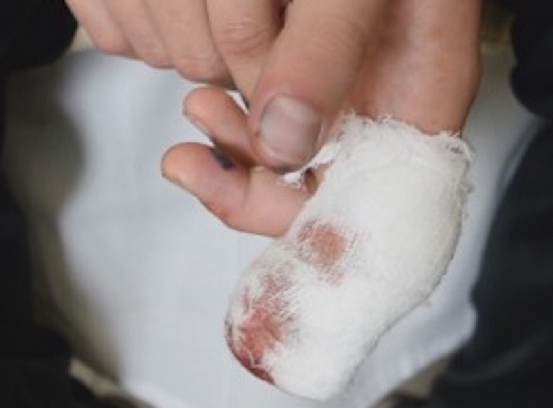 Софиянец се е наранил с пиротехническо средство в монтанското село