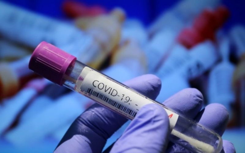 Новите потвърдени случаи на коронавирус у нас за последното денонощие са 68