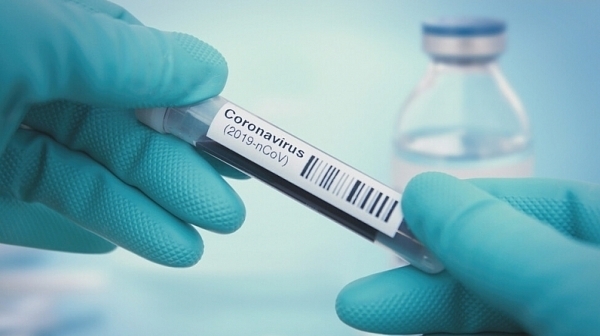 142 са новите случаи на коронавирус у нас Направени са