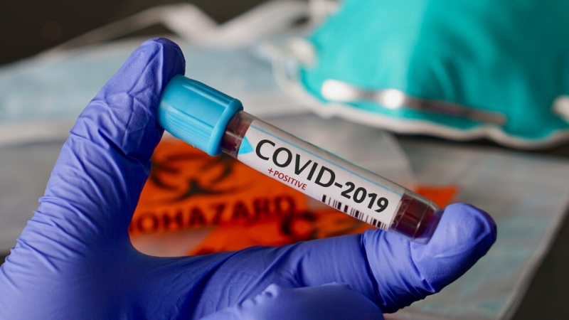 Новите потвърдени случаи на коронавирус у нас за последното денонощие са 599, сочат