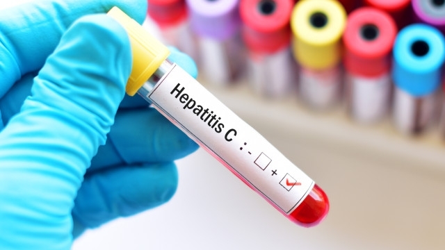 44 човека, заразени с хепатит С, са открити в рамките