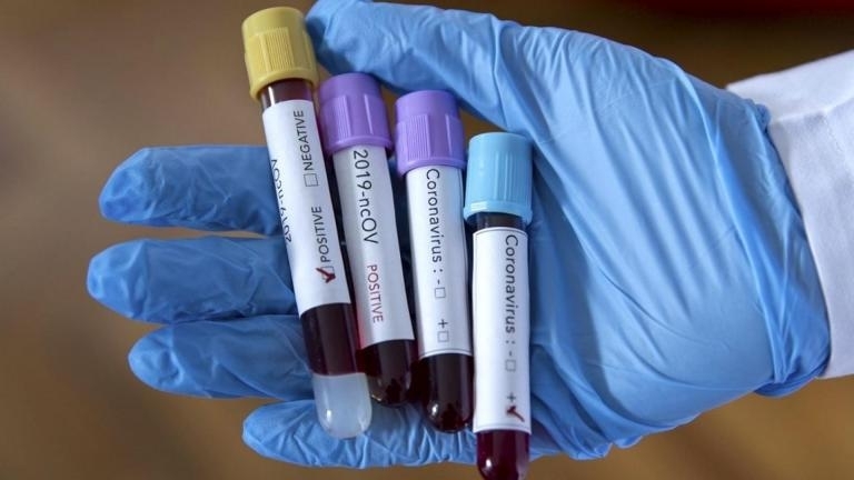 174 са новодиагностицираните с коронавирусна инфекция лица през изминалите 24