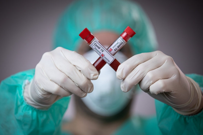 Още 388 случая на заразяване с новия коронавирус са установени