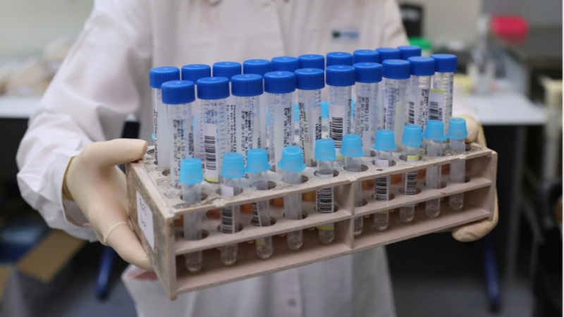 255 са новозаразените с коронавирусна инфекция лица при направени 5047