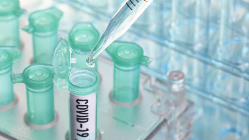 Три проби за коронавирус изпратени до Националната референтна лаборатория са