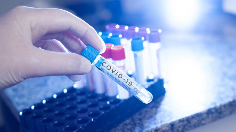 Нови 155 случая на заразяване с коронавирус са регистрирани в