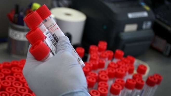 Един нов случай на коронавирус в област Видин е регистриран