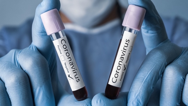 1225 са новодиагностицираните с коронавирусна инфекция лица през изминалите 24