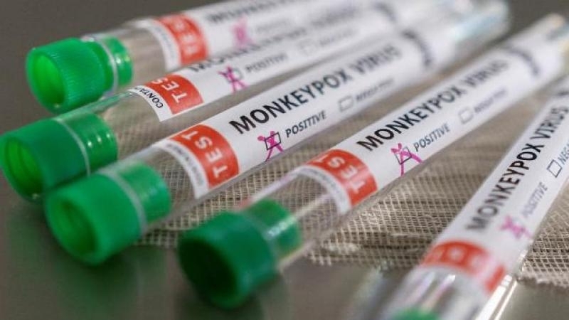 Два различни варианта на маймунска шарка са засечени в САЩ