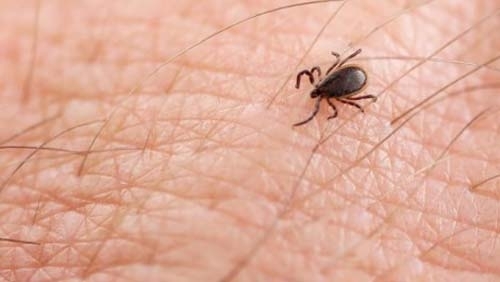 През изминалата седмица са регистрирани 4 случая на Лаймска борелиоза