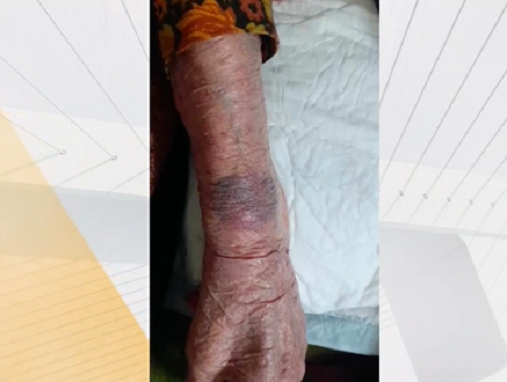 104 годишна жена е връзвана за крайниците докато е била на