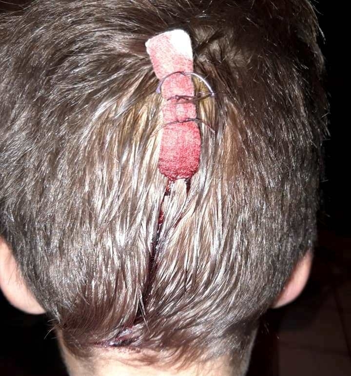 Първокласник от ромски произход е причакал и нападнал други двама