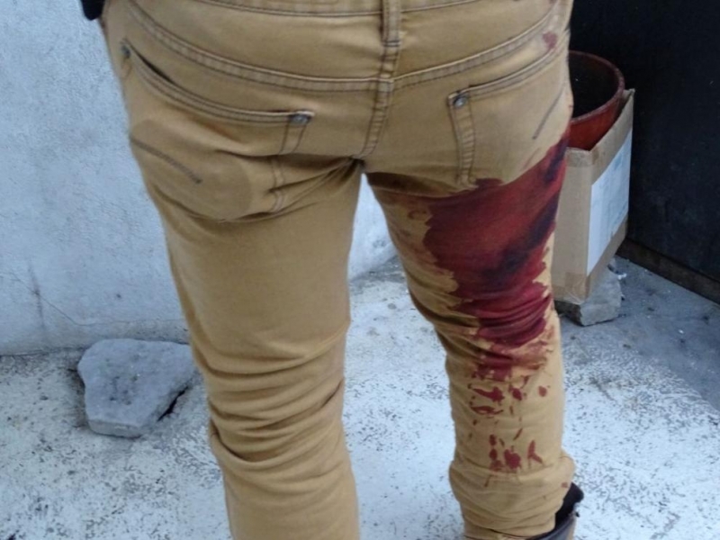 Трима младежи бяха наръгани с нож на излизане от дискотека в Благоевград тази сутрин