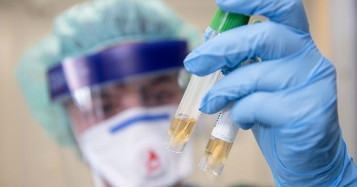 2737 са новодиагностицираните с COVID 19 лица у нас за изминалите 24