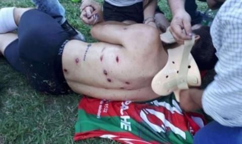 Полицейски служители откриха стрелба срещу футболисти Инцидентът се разиграва на