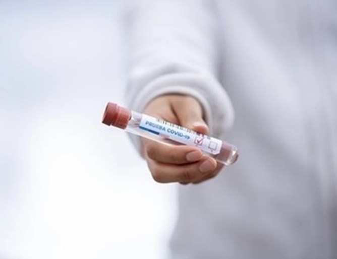 Разкриха схема за издаване на отрицателни PCR тестове в Русе