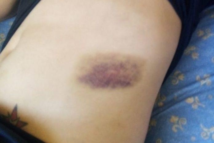 Мъж насини жена в Плевен съобщиха от полицията На 3 януари е получен