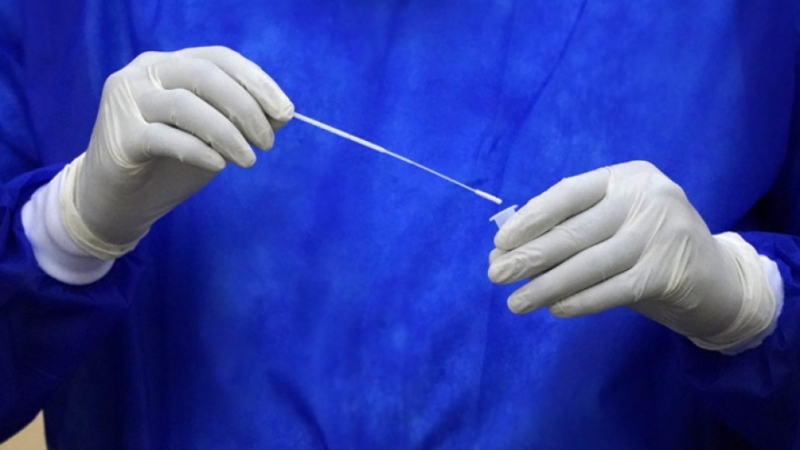 120 са новите случая на COVID 19 у нас с 93