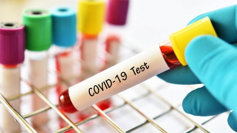 Добрата новина: Няма регистрирани случаи на COVID-19 у нас за последните 24 часа