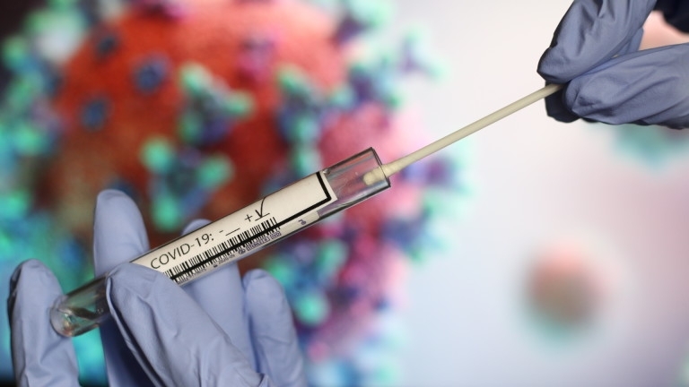 3440 са новодиагностицираните с COVID 19 лица у нас за изминалите