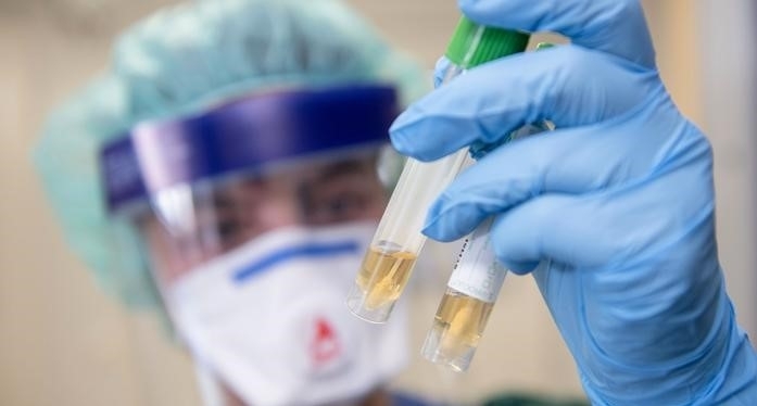 1615 са новозаразените през последното денонощие с коронавирус при изследвани