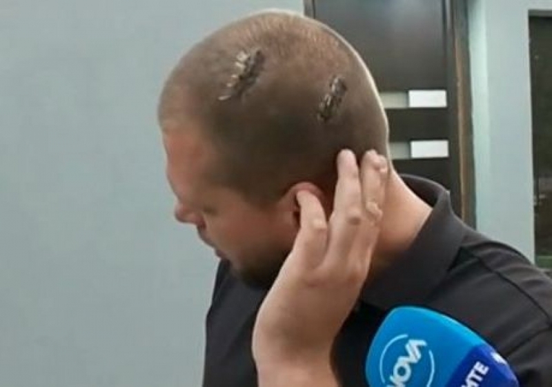 Мъж от костинбродското село Петърч е бил на косъм от смъртта