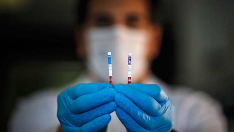 63 новорегистрирани случаи на болни от Коронавирусна инфекция в област