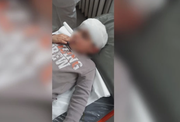 Куче нападна 5 годишно дете в Ловеч Момченцето е с ухапвания