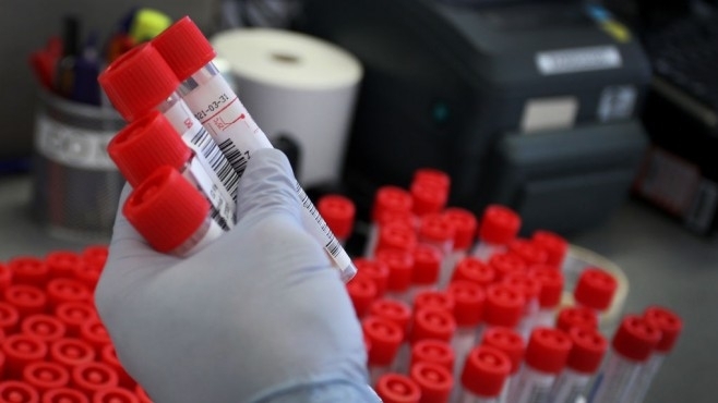 Новите случаи на заразени с коронавирус у нас през последните