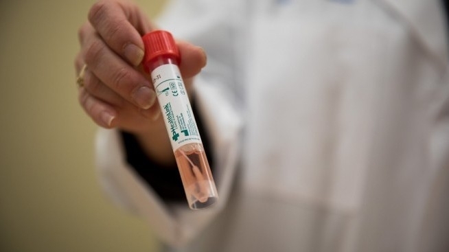 8 са новите случаи доказани днес след провеждане на лабораторни