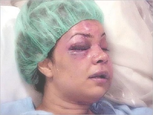 Задържаха за 72 часа мъж пребил жена си във Видинско