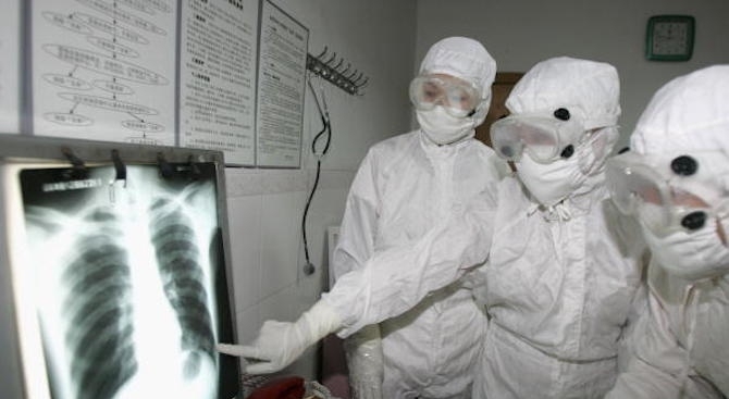 Жител на Хонконг бе диагностициран с нов вид Хепатит Е който досега