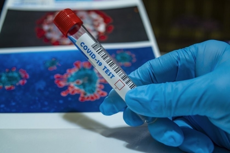 Новите потвърдени случаи на коронавирус у нас за последното денонощие са 309