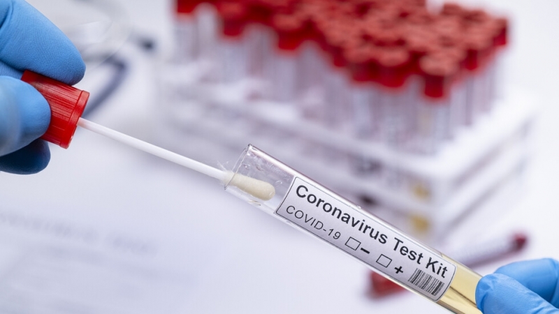 171 са новозаразените с коронавирус у нас през изминалите 24