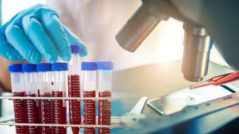 Нови 23 случая на Covid 19 са регистрирани в България за