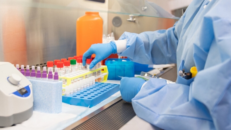 1029 служители на кланица в Германия са заразени с коронавирус