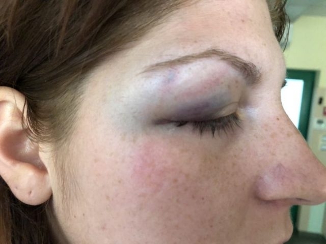 Мъж удари жена на работното ѝ място в старозагорско село съобщиха от