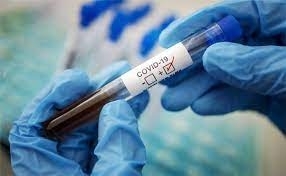 360 нови случая на болни от COVID-19 са били регистрирани