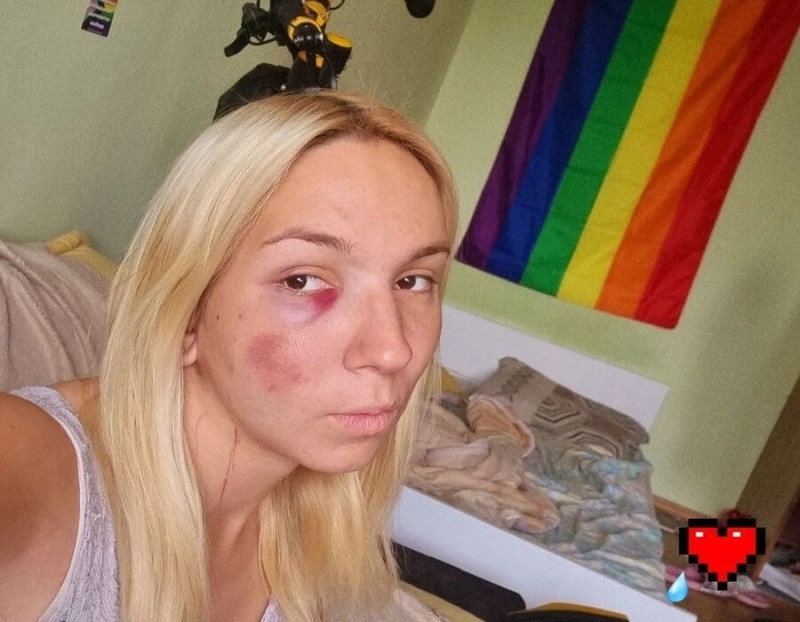 Опит за самоубийство е направила Емили – трансмомичето с тротинетката