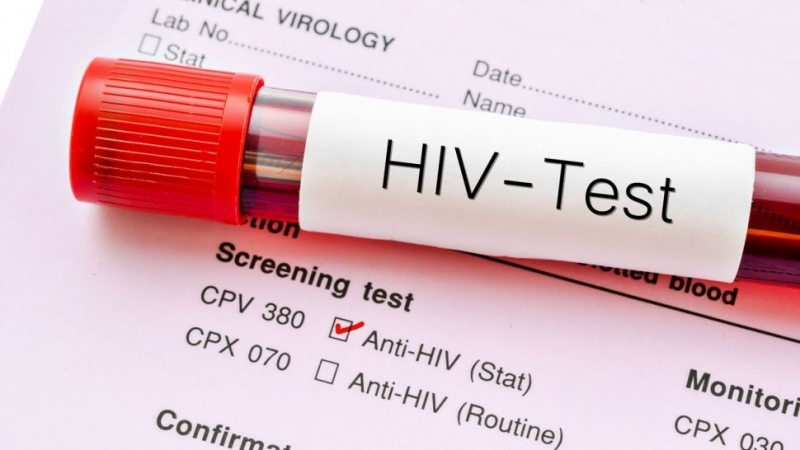 Внимание! Нов случай на HIV във Враца
