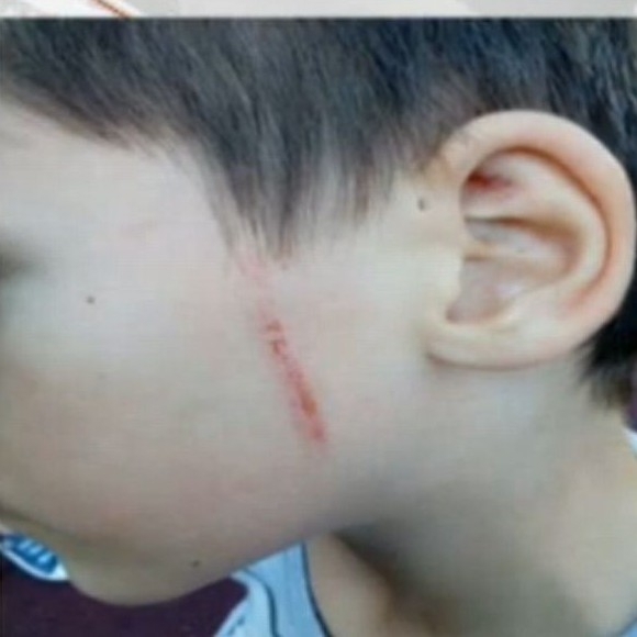 Уволниха учителка заради насилие над дете