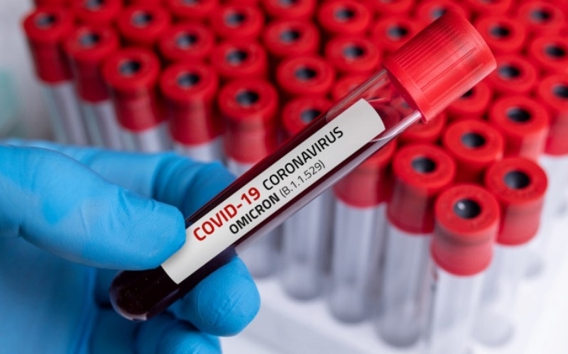 257 са новите потвърдени случаи на COVID 19 за последните 24 часа у нас Това